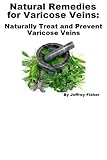 Image de Natural Remedies for Varicose Veins: Naturally Treat and Prevent Varicose Veins (English Edition)