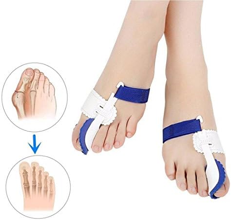 1 pair Hallux Valgus & Bunion Correction Pads Pain Relief & Correction Pads Night Bunion Splint Pads Toe