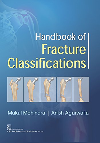Handbook Of Fracture Classifications (Pb 2017)