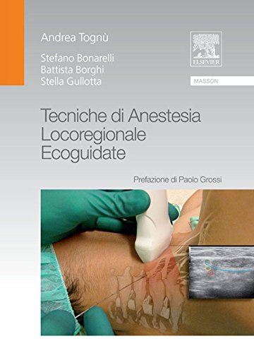 Tecniche di anestesia locoregionale ecoguidate Tecniche di anestesia locoregionale ecoguidate