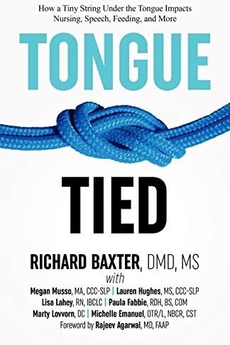 Tongue-Tied: How a Tiny String Under the Tongue Impacts Nursing, Speech, Feeding, and More
