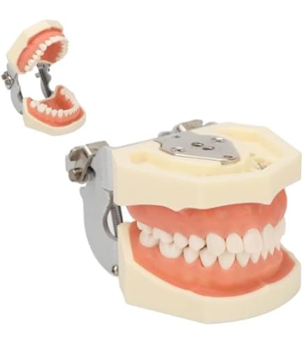 Sostituzione Denti: Tecniche E Costi Dell'impianto Dentale - Foto 3