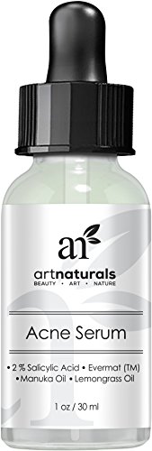 Art Naturals® Anti Acne Serum Treatment 30ml- Dermatologist Tested Product, Made with Revolutionary Evermat® & Organic Ingredients to Help Control & Get Rid of Acne - Best Pore Minimizer -For all Ages