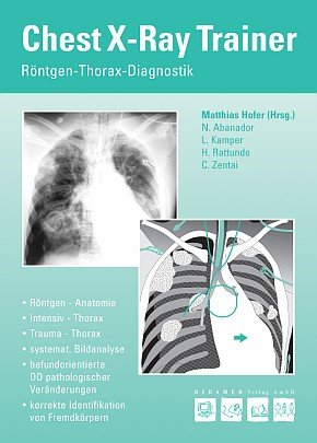 Download Chest X Ray Trainer Röntgen Thorax Diagnostik Pdf - 