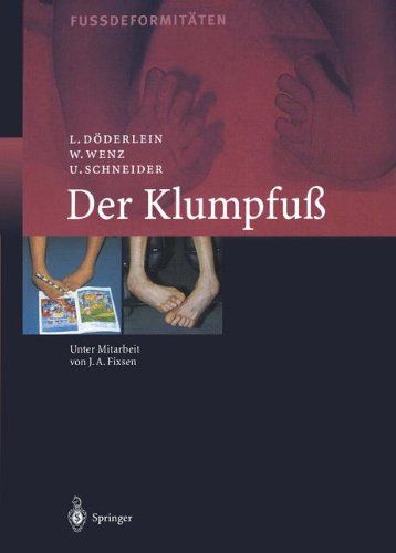 Preisvergleich Produktbild Der Klumpfuss: Erscheinungsformen und Behandlungsprinzipien jeden Alters. Differentialdiagnose und Differentialtherapie
