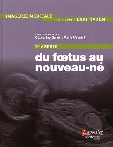 Free Imagerie Du Foetus Au Nouveau Né Pdf Download Braydeniago - 