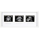 Pearhead 87038 Trimester Sonogram Frame Deluxe, fotoğraf &ccedil;er&ccedil;evesi i&ccedil;in &uuml;&ccedil; Ultraschallaufnahmen, beyaz