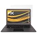 Produktbild Trekstor SurfBook W1 Displayschutzfolie - 2 x atFoliX FX-Antireflex blendfreie Folie Schutzfolie
