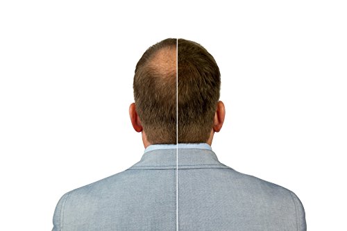 Plus additional hair Haarauffüller für Männer & Frauen – mit Soforteffekt – 25 g – gegen Teilglatze – verschiedene Farben – Haarverdichtung (schwarz) - 6