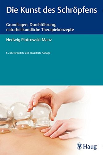 Preisvergleich Produktbild Die Kunst des Schröpfens: Grundlagen, Durchführung, naturheilkundliche Therapiekonzepte