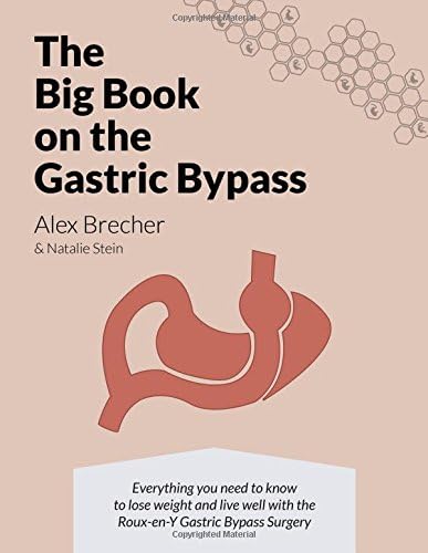 The BIG Book on the Gastric Bypass: Everything You Need To Know To Lose Weight and Live Well with the Roux-en-Y Gastric Bypass Surgery: Volume 3 (The BIG books on Weight Loss Surgery)