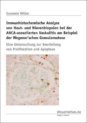 Immunhistochemische Analyse von Haut- und Nierenbiopsien bei der ANCA-assoziierten Vaskulitis am Beispiel der Wegener'schen Granulomatose: Eine ... Beurteilung von Proliferation und Apoptose