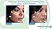Omiera Labs Facial Hair Inhibitor & Acne Spot Treatment Cream and Cleanser 3Pc Skin Care Set
