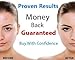 Royal BeauteÂ® Remove Blackheads Today!! With Premium Blackhead & Blemish Remover Kit - Acne Treatment - 7 Professional Dermatologist Grade Tools - Easily Cure Pimples, Blackheads, Comedones, Acne, and Facial Impurities (Black)