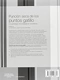 Image de Punción Seca De Los Puntos Gatillo