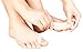 Zehenspreizer 2-in-1, Ballenschutz PLUS Zehenschiene – 1 PAAR – Weiche, Gepolsterte Zehenschiene aus Silikongel & Hallux Valgus Schutz / Schiene – Angenehme Ballenschiene Gegen Schmerzen
