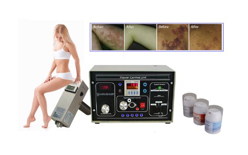 SDPL-105iD X Permanent Birth Mark, Port Wine Stain & Rosacea Removal Machine Kit.