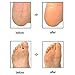 Solrngen Foot Rasp Callus Callous File Dry Hard Dead Skin Corn Remover Shaver...