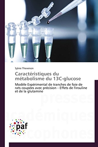 Caractéristiques du métabolisme du 13c-glucose gratuit Caractéristiques du métabolisme du 13c-glucose gratuit