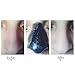 FaceApeel Blackhead Remover - Peel-off Mask for Men and Women - Deep Cleans Better than Pore Strips for Instantly Brighter and Smoother Skin - Works on Face and Body!