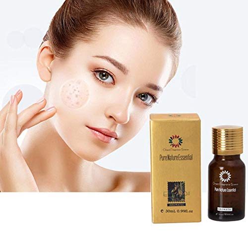 Preisvergleich Produktbild alian Supertop Ultra Brightening Spotless Öl Dark Spots Entfernung Altersflecken Hyper-Pigmentierung für Körper Hals Dark Spot Corrector Verbessert für dunkle Haut von alian