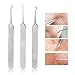 FEITONG 3pcs Curved Blackhead Comedone Clip Needle Tweezers Pimple Extractor Remover (Silver)