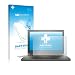 Produktbild upscreen Lenovo ThinkPad X240 Non-Touch Antibakterielle Schutzfolie Matt - Anti-Reflex Displayschutzfolie, Anti-Fingerprint, Anti-Kratzer