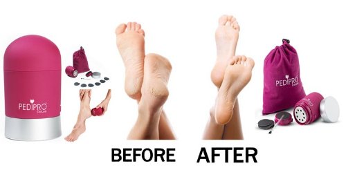 Aparato Pedicura PediPro Deluxe