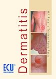 Image de Dermatitis