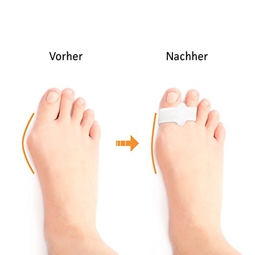 Blissany Zehenspreizer (Softgel Silikon|2 Stück) – Zur Vorbeugung und Linderung von Hallux Valgus und anderen Fehlstellungen der Zehen - 5