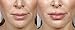 WUNDER2 WUNDERKISS Controlled Lip Plumping