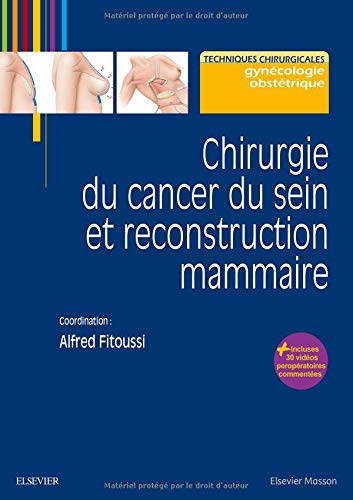 Download Chirurgie du cancer du sein et reconstruction mammaire Download Chirurgie du cancer du sein et reconstruction mammaire