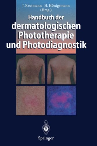 Preisvergleich Produktbild Handbuch der dermatologischen Phototherapie und Photodiagnostik