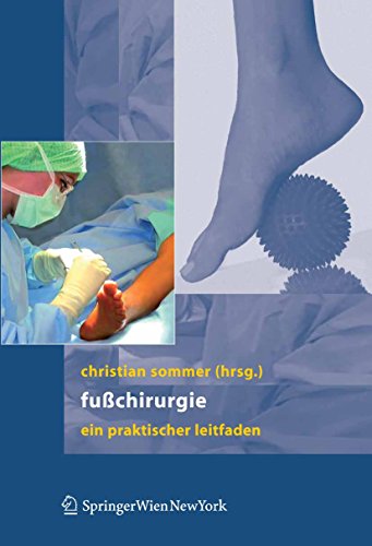 Download Fußchirurgie: Ein praktischer Leitfaden Download Fußchirurgie: Ein praktischer Leitfaden