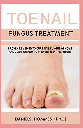 Preisvergleich Produktbild TOENAIL FUNGUS TREATMENT: Natural Toenail Fungus Treatment and Cures