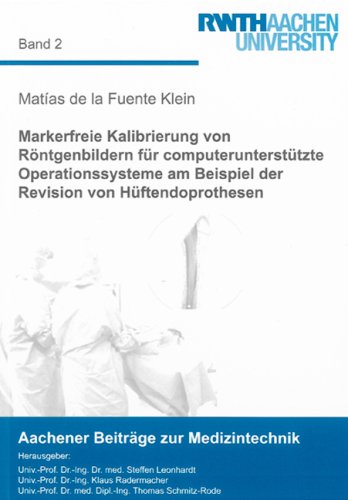 Markerfreie Kalibrierung von Röntgenbildern für computerunterstützte Operationssysteme am Beispiel der Revision von Hüftendoprothesen