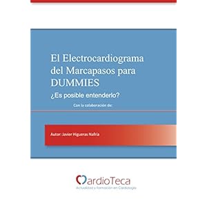 El Electrocardiograma del Marcapasos para Dummies. ¿Es posible entenderlo?: El libro definitivo para médicos no cardiólogos para poder entender el