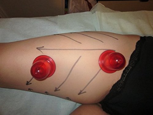 Beauty Care Silikon Schröpfen Massage Anti-Cellulite-Cups Schönheitstherapie-Massage Schröpfen Tasse - 8