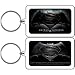 Produktbild Officially Licensed & Trademarked Products Batman vs Superman Dawn of Justice Logo - DC Comics - Lucite Keychain Schlüsselanhänger