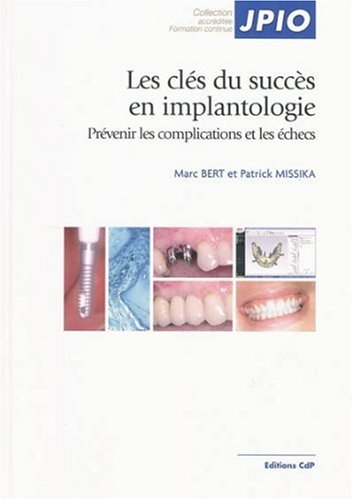 Book's Cover ofLes clés du succès en implantologie Prévenir les complications et les échecs