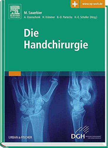 Download Die Handchirurgie: mit Zugang zur Medizinwelt Download Die Handchirurgie: mit Zugang zur Medizinwelt