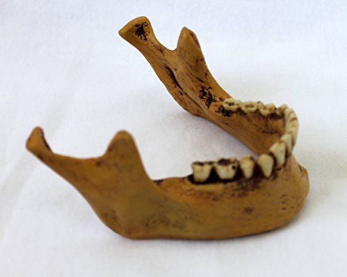 Anatomie Schädel mit Unterkiefer von Markus Mayer - 7