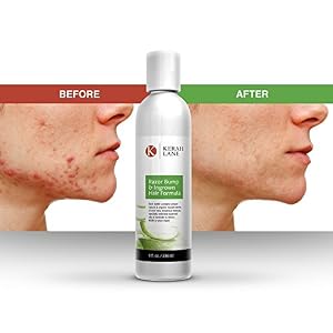 Kerah Lane Razor Bump & Ingrown Hair Formula 8 Oz for Women & Men: Best Treatment Serum for Ingrown Hairs, Acne, Razor… - Image 8