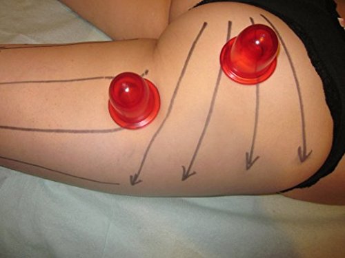 Beauty Care Silikon Schröpfen Massage Anti-Cellulite-Cups Schönheitstherapie-Massage Schröpfen Tasse - 7