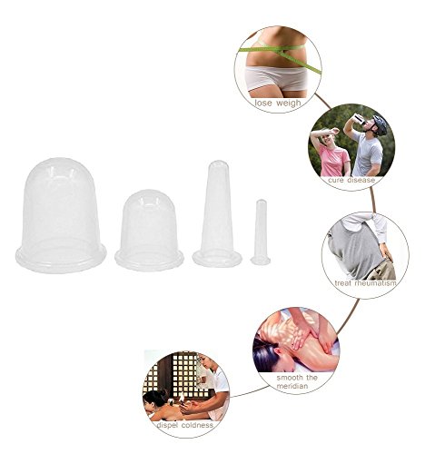 NALATI 4Stk Schröpfen Cups + 1er Pinsel (Farbe zufällig) Hautpflege Silikon Schröpfen Cups Massage Set für Gesicht Körper gegen Fett - 5