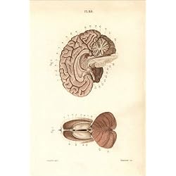 Cuadro sobre lienzo 100 x 150 cm: Cross sections through the brain