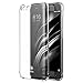 Produktbild XiaoMi Mi6 TPU Hülle - SMTR Advanced Shock Absorption Technology Ultradünn Weich Silikon Schutzhülle für XiaoMi Mi6 - Transparent
