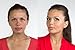 Bare Face Minerals Full Coverage Mineral Foundation | Long Lasting | Oil Free Loose Powder Foundation | Rosacea Burns Freckles Acne Makeup Solutions | 8g NET (Soft-Beige)