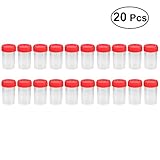 muestra orina 24 horas Set de 20 piezas de tazas de orina de 60 ml.
