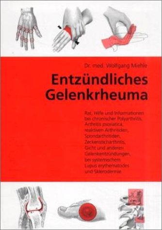 Preisvergleich Produktbild Entzündliches Gelenkrheuma